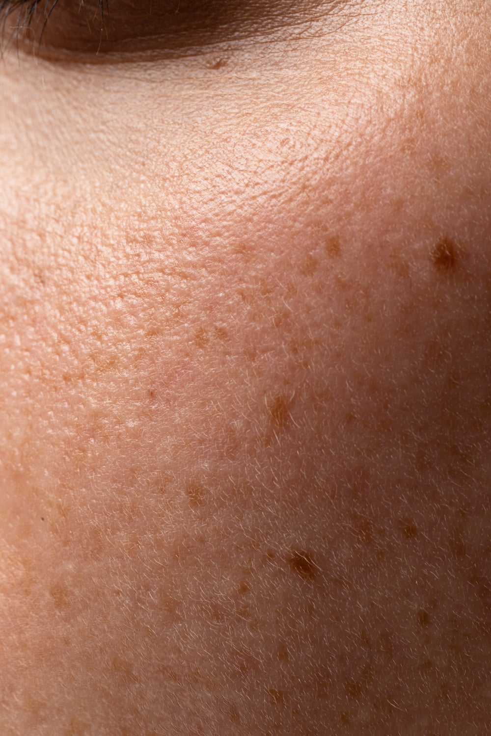 Common Skincare Mistakes That May Be Damaging Your Skin